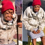 31 Year Old Woman Ages Overnight in South Africa — The Shocking True Story of Snenhlanhla Khoza 31 year old woman Snenhlanhla Khoza from KwaZulu-Natal South Africa showing rapid aging symptoms believed to be Werner Syndrome